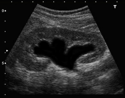 an ultrasound image